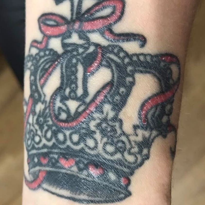 Сильная аллергия при татуаже и татуировке - можно ли себя защитить ?