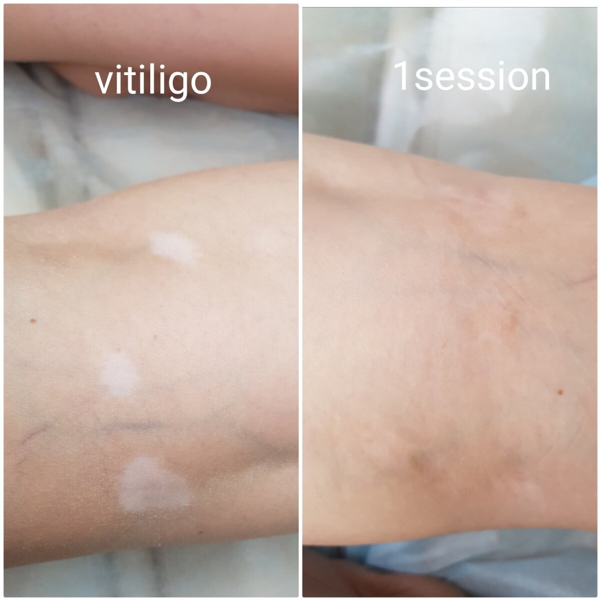 Делать ли перманентный макияж или это большая ошибка?