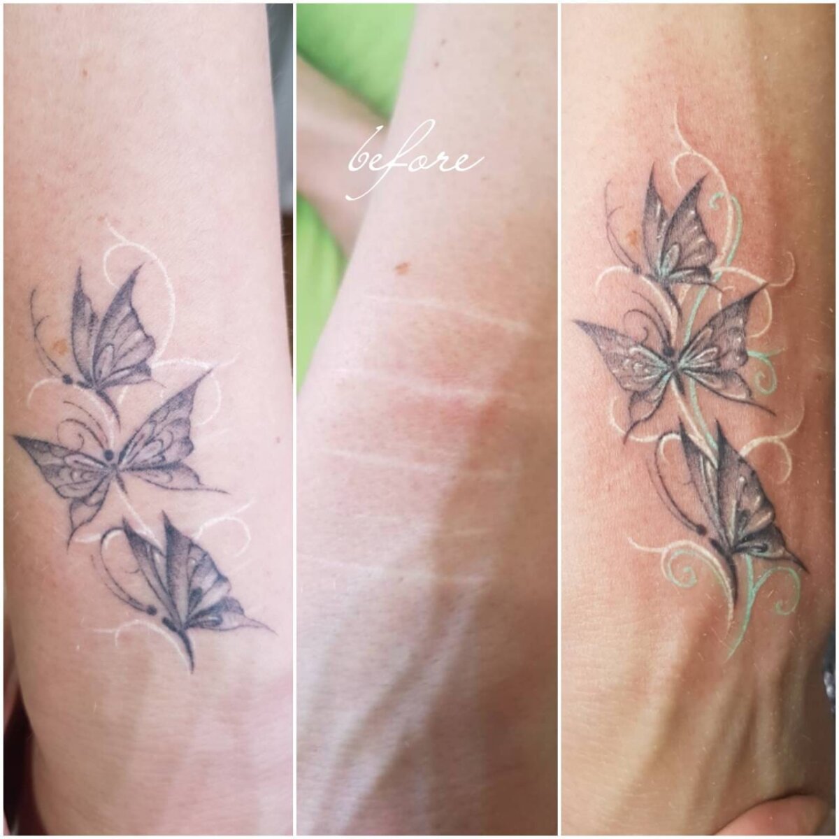 Новая глава истории моей борьбы со шрамами - следами жизни