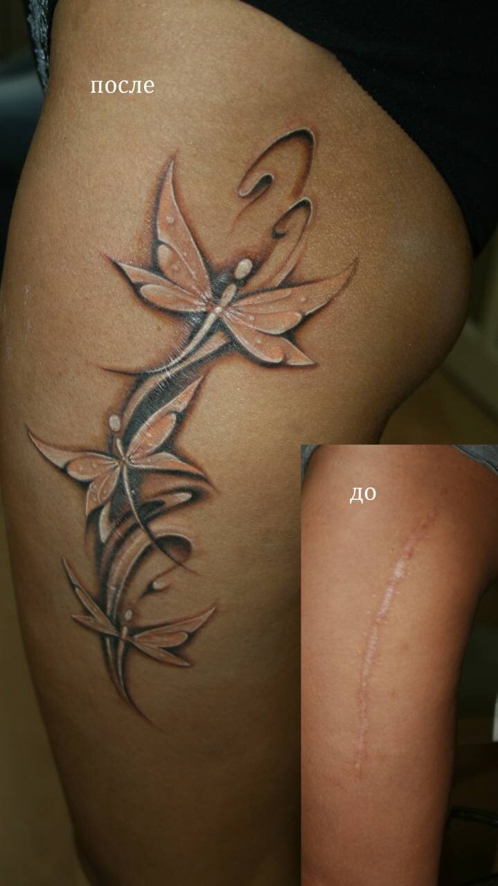 Новая глава истории моей борьбы со шрамами - следами жизни